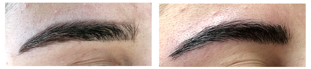 microblading vorher nachher 14